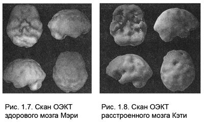Измени мозг - изменится и тело _7.jpg
