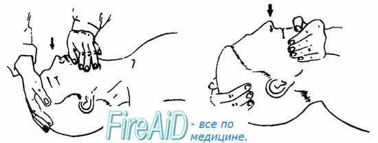 Методичка по первой помощи i_001.jpg
