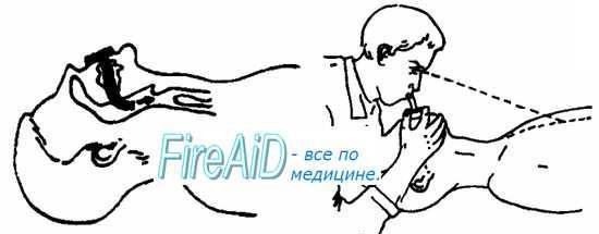 Методичка по первой помощи i_003.jpg