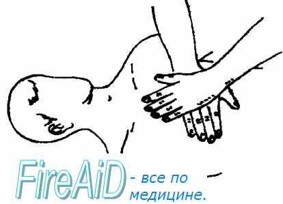 Методичка по первой помощи i_007.jpg