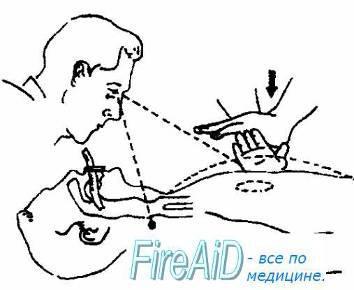 Методичка по первой помощи i_010.jpg