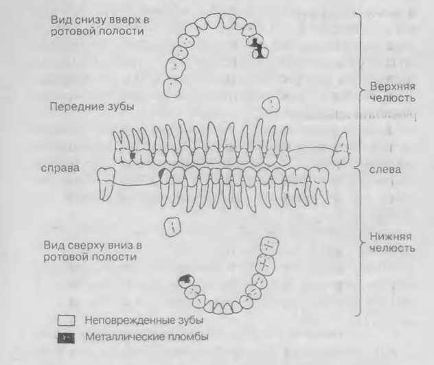 Двойники. Правда о трупах в берлинском бункере _26.jpg