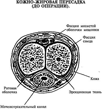 Как увеличить размеры мужского полового члена i_037.jpg